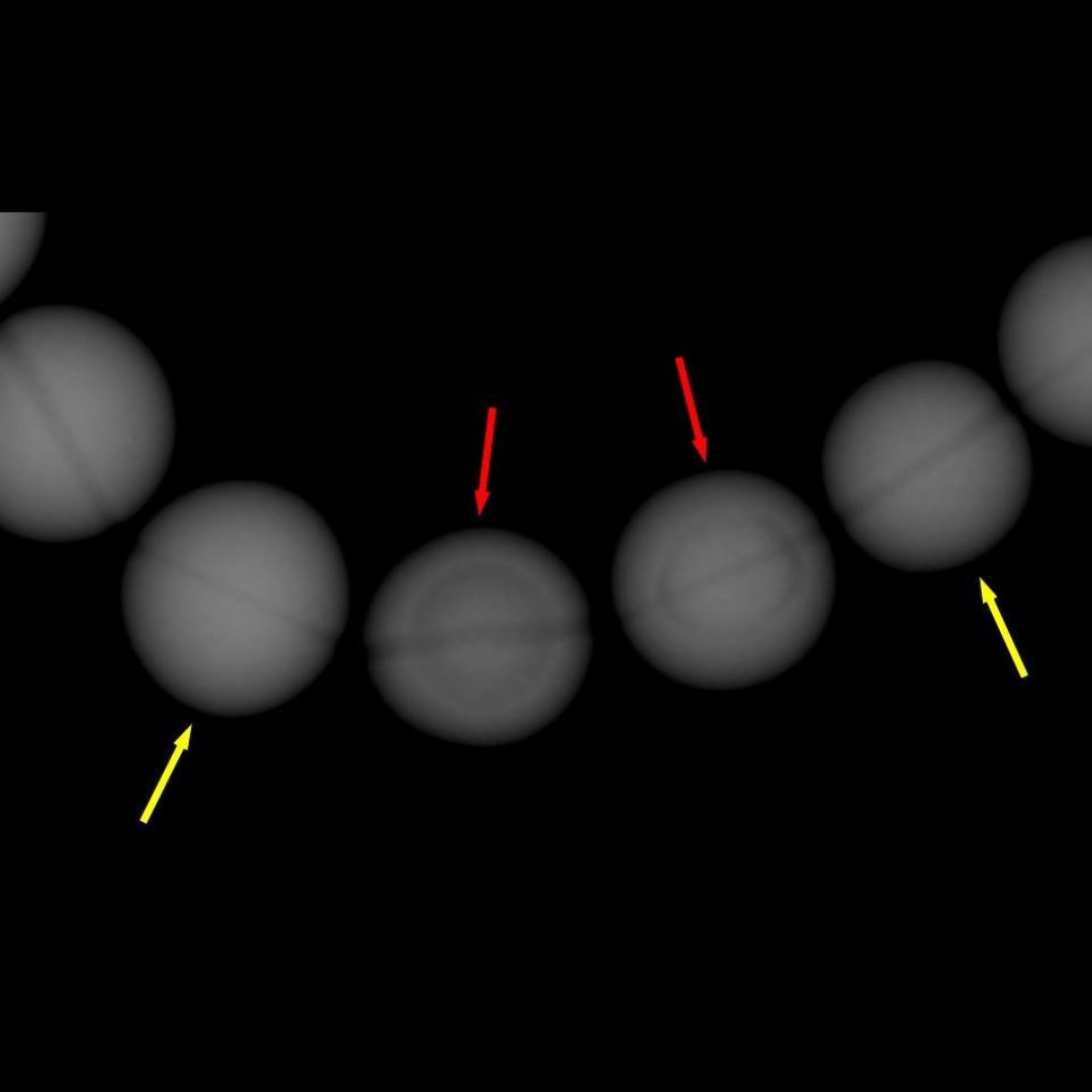 Evoluzione delle tecniche radiografiche nell’indagine delle Perle